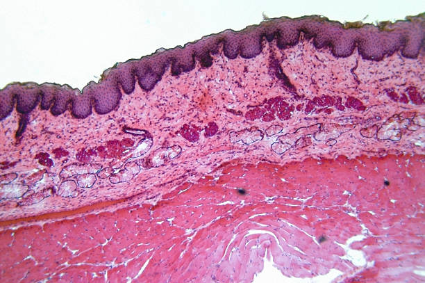 Ảnh 2 của Squamous Cell Carcinoma